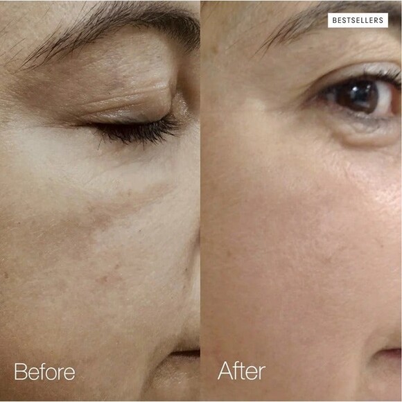 NIB SKIN INC My Daily Dose of Vitamins ABC Serum Balance Detox Texture Tone - Picture 5 of 12